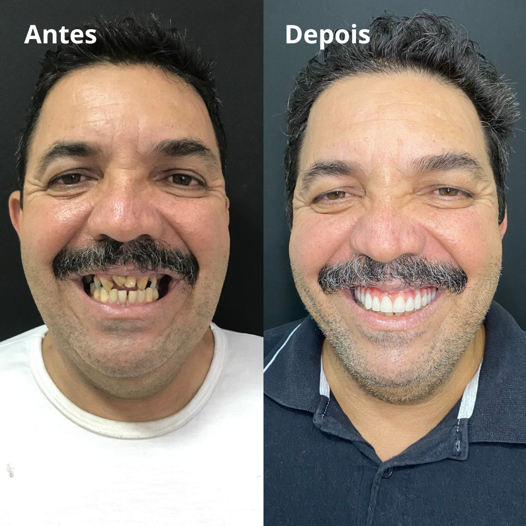 Belle odonto - antes e depois (1)