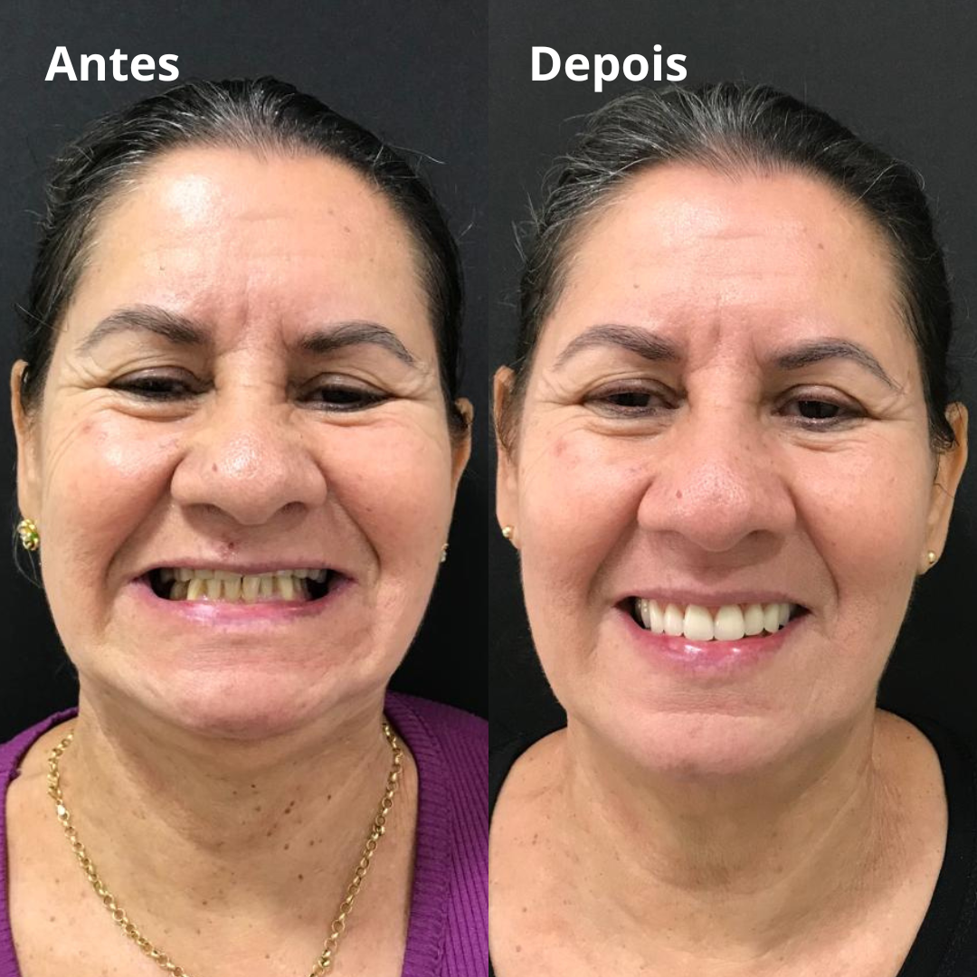 Belle odonto - antes e depois (2)