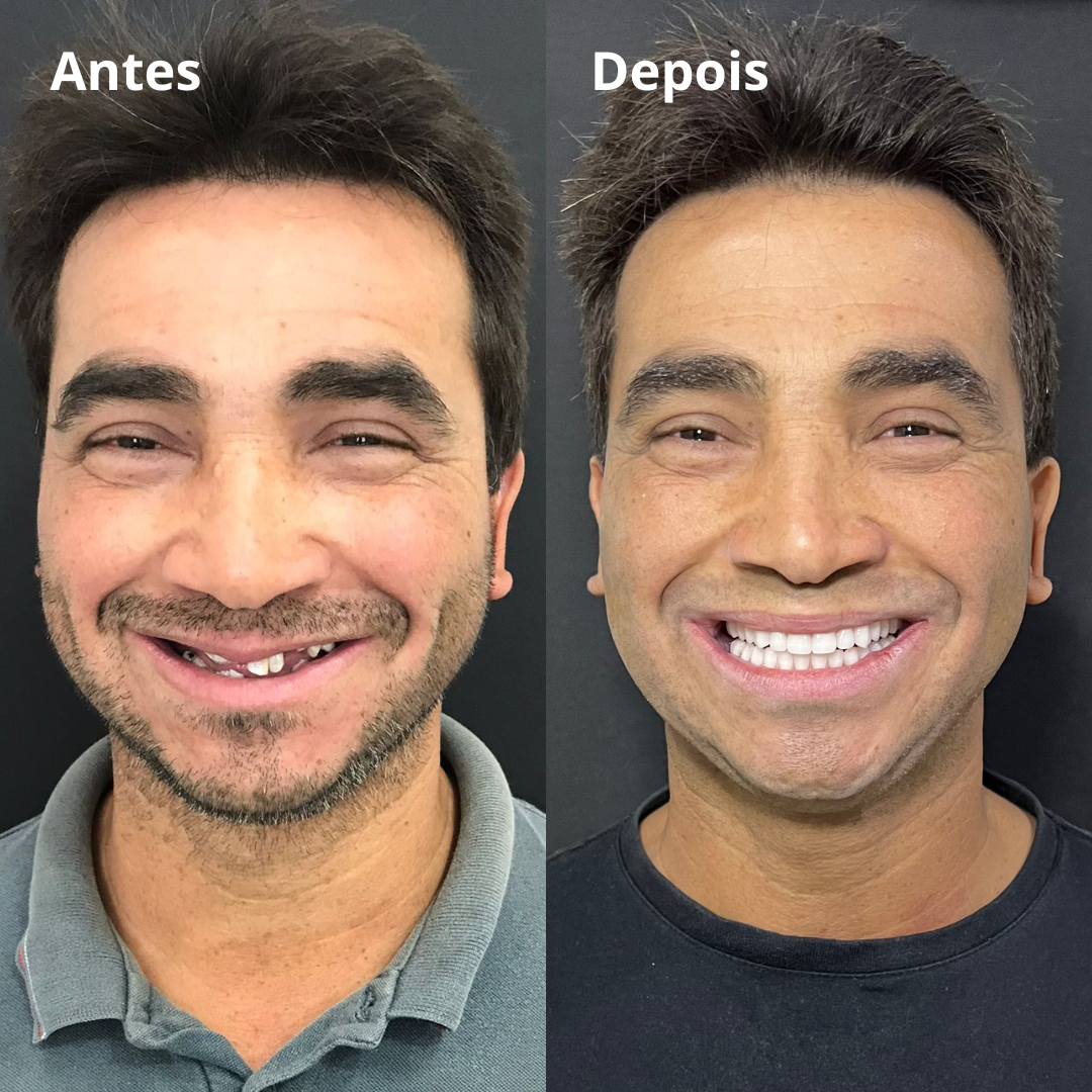 Belle odonto - antes e depois (3)