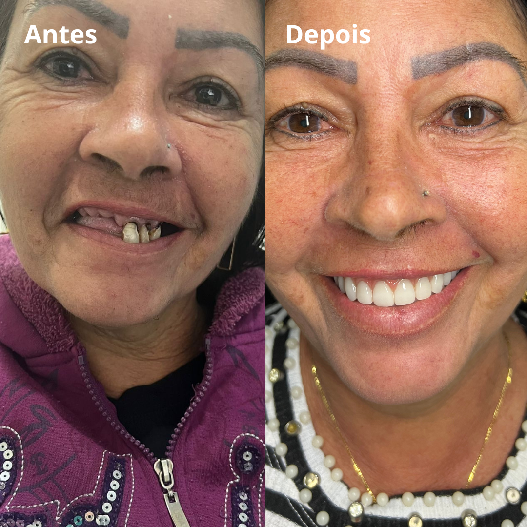 Belle odonto - antes e depois (4)
