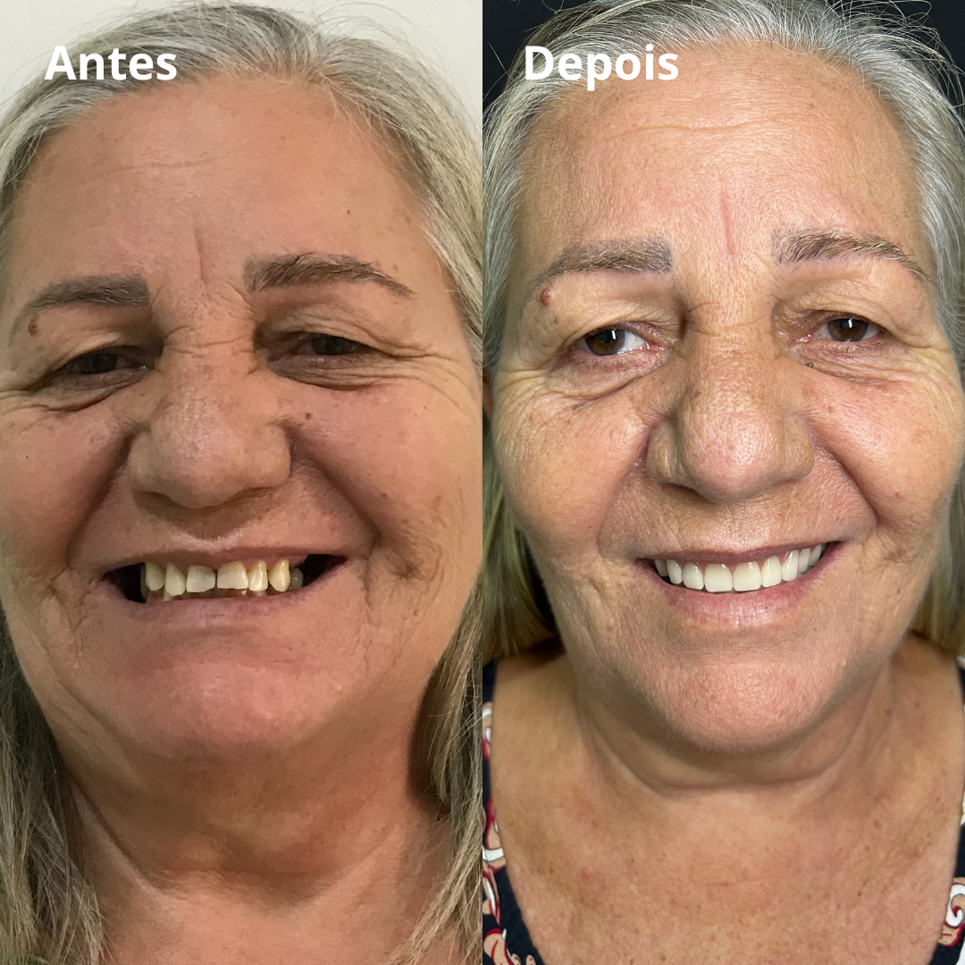 Belle odonto - antes e depois (5)