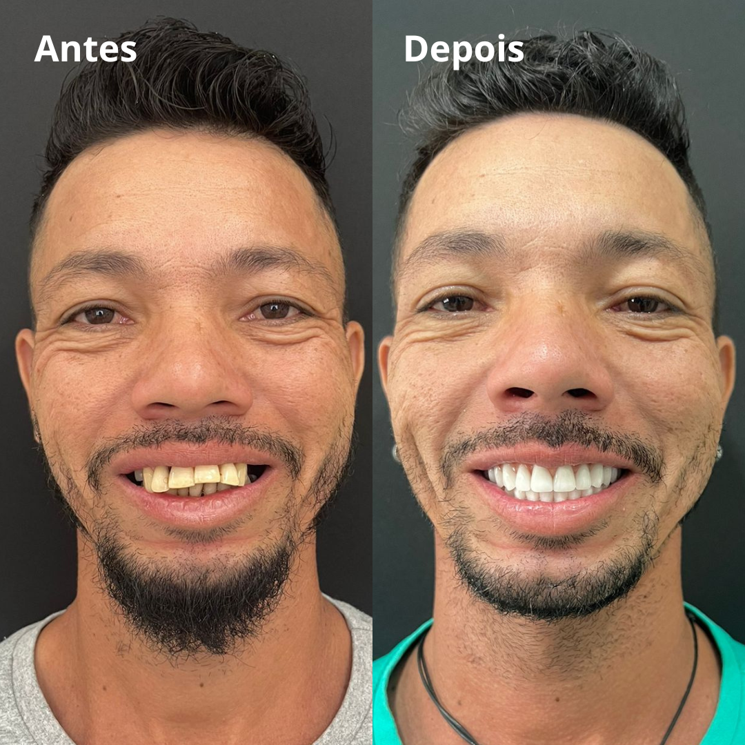 Belle odonto - antes e depois (6)